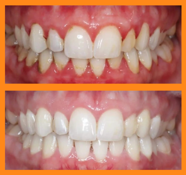 Gum Disease and Overall Health: What Research Shows